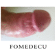 fomedecu